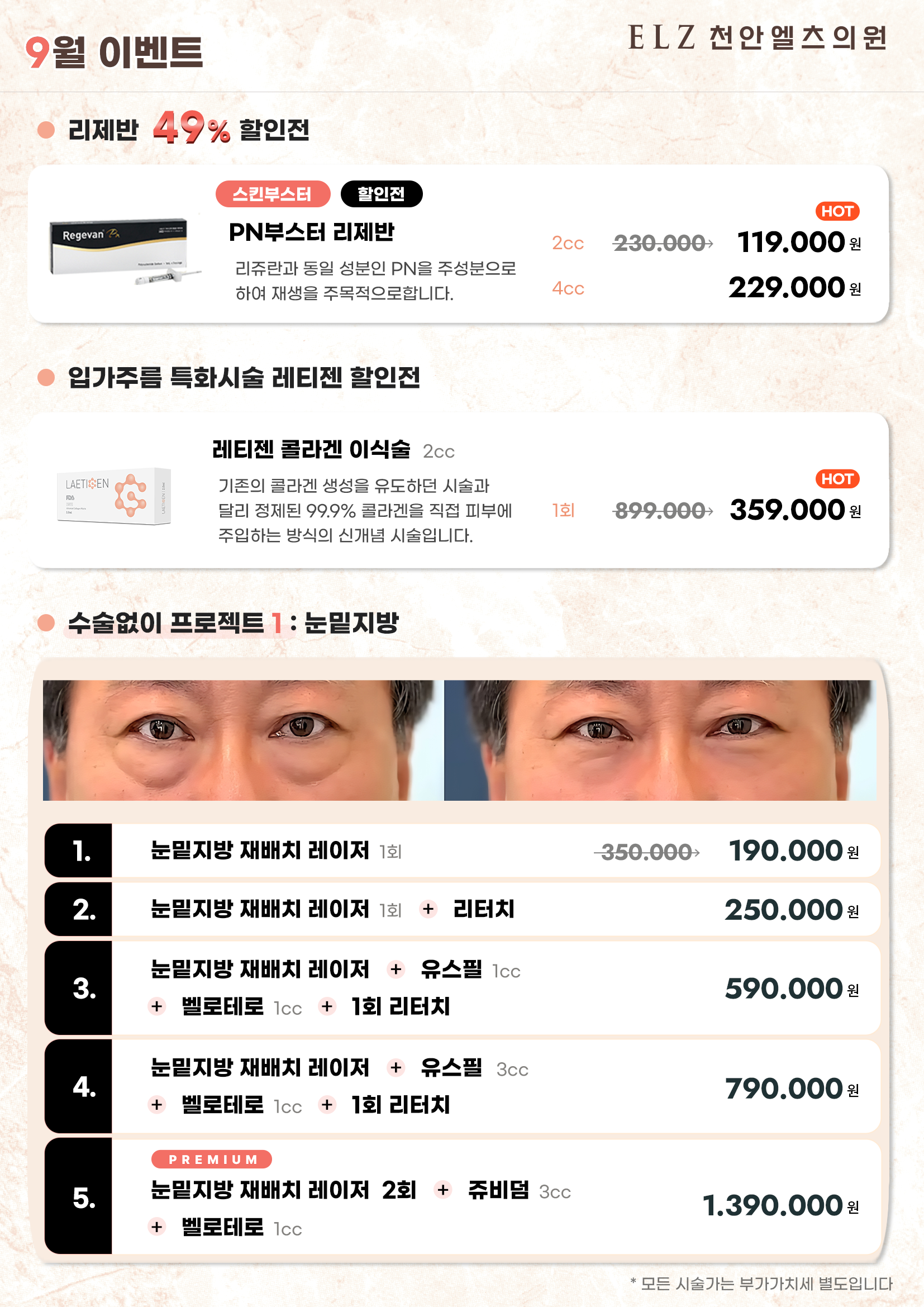 9월 이벤트 - 천안 엘츠의원 (3)