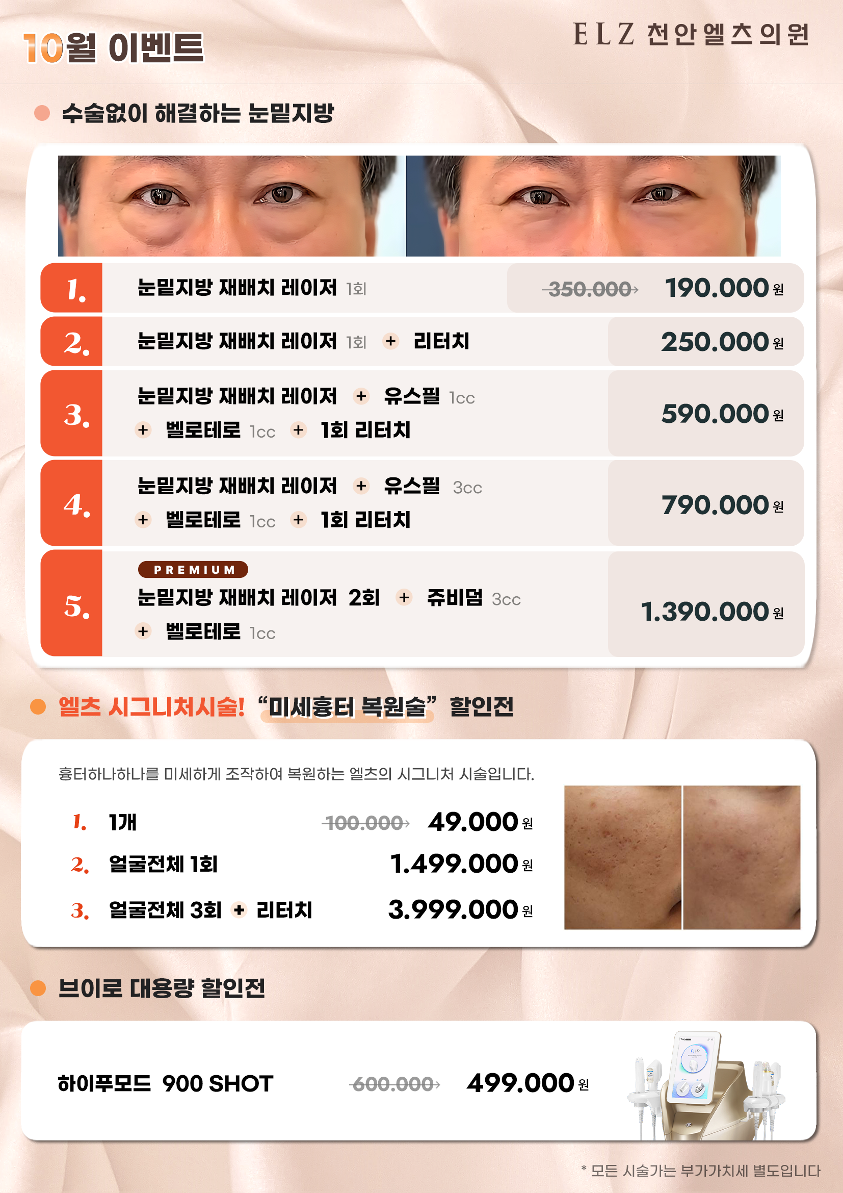 10월 이벤트 - 천안 엘츠의원 (4)
