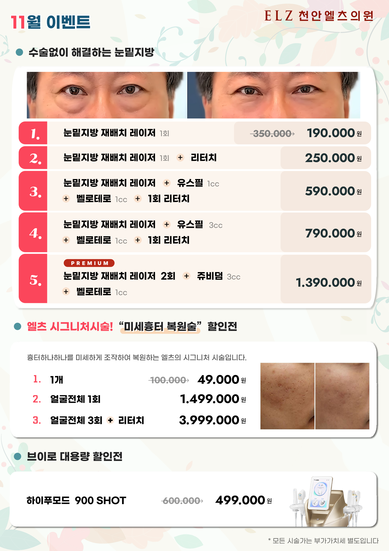 11월 이벤트 - 천안 엘츠의원 (4)