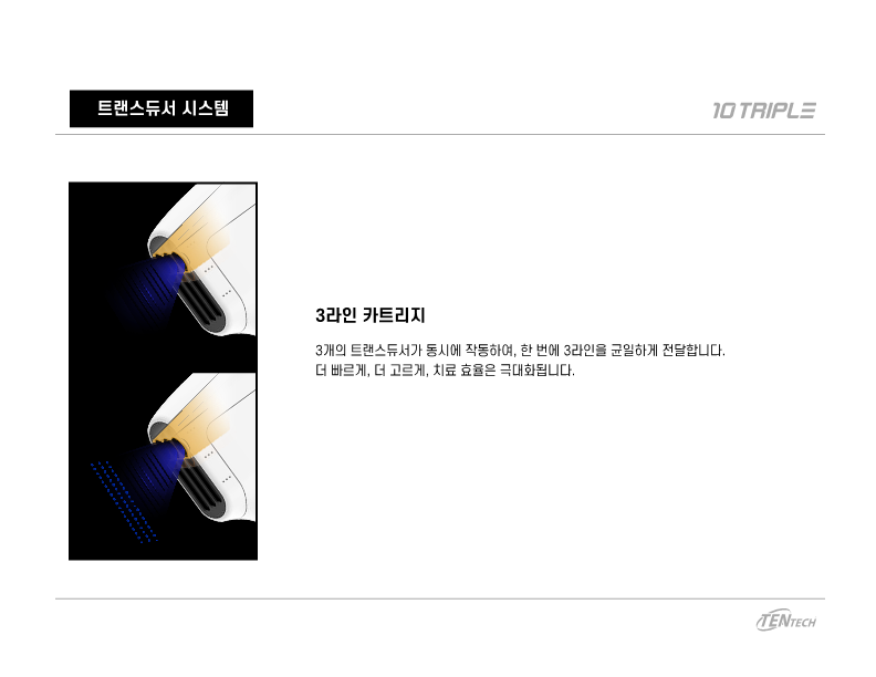 텐트리플 리프팅 - 천안 엘츠의원 (5)