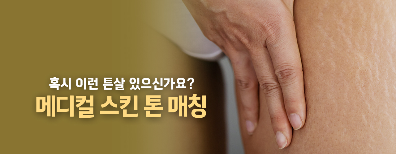 이런시술어때요? - 천안 엘츠의원 (5)